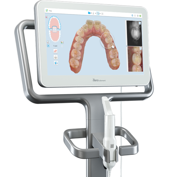 iTero Element scanner