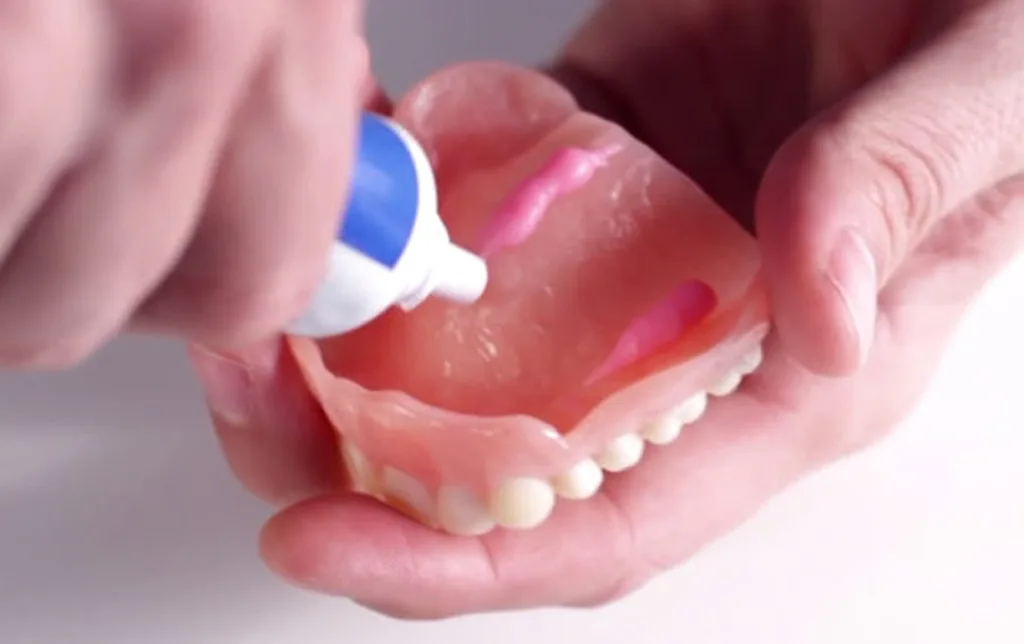 A Denture Adhesives that Keeps Loose-Fitting Dentures in Place