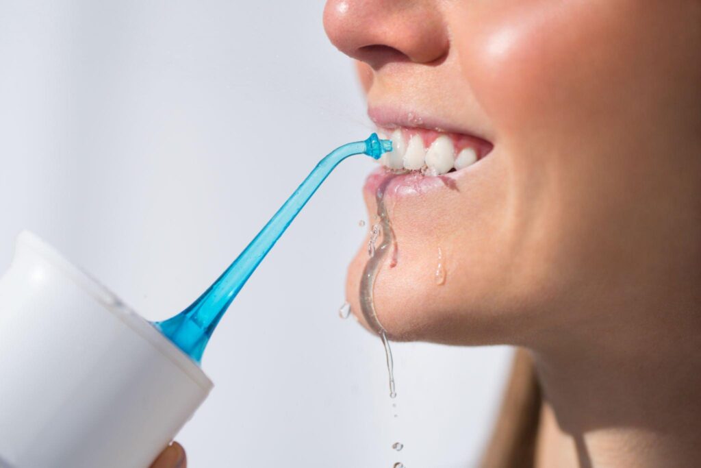 Oral Irrigator