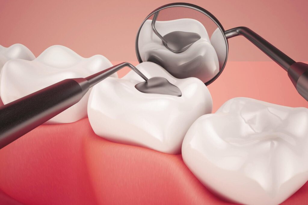 composite fillings harmful