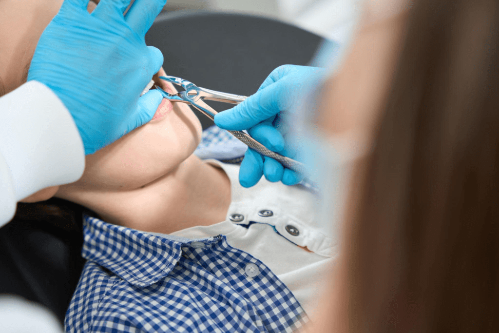 Tooth extractions