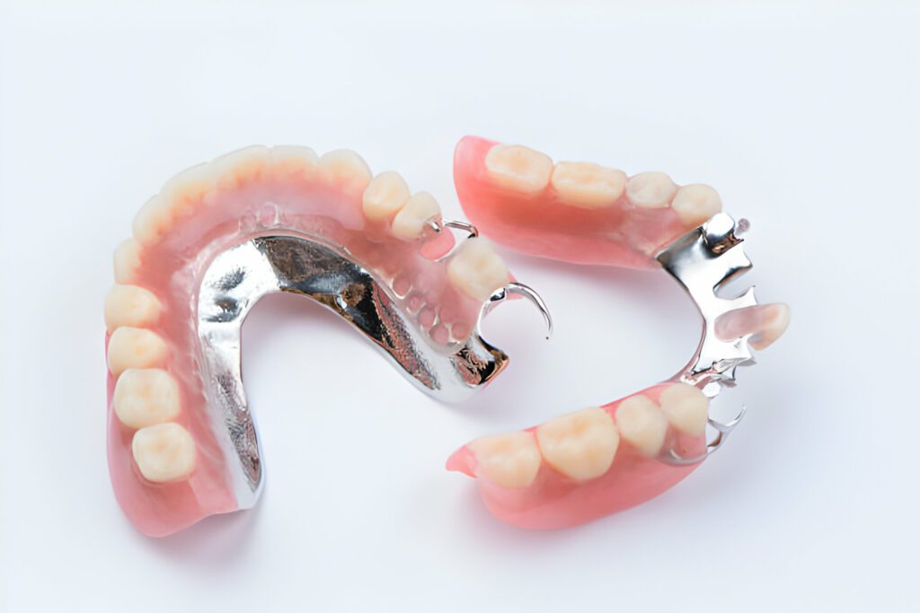 Denture Breakage