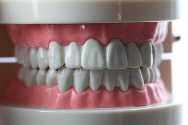 denture costs